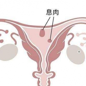 卵巢问题需要做哪些功能检查