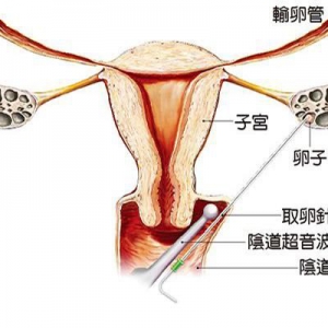 卵巢功能检查包含哪几项