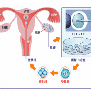 子宫肌瘤初期有什么明显症状